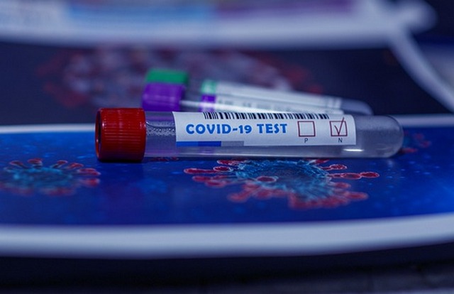В Смоленской области провели 135288 тестов на наличие COVID-19