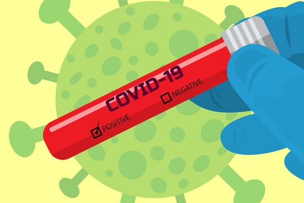 В Смоленской области провели 136365 тестов на наличие коронавируса