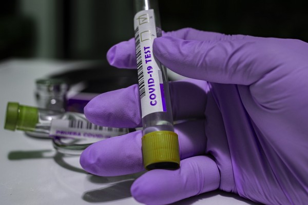 За сутки в Смоленске выявили 153 заболевших коронавирусом