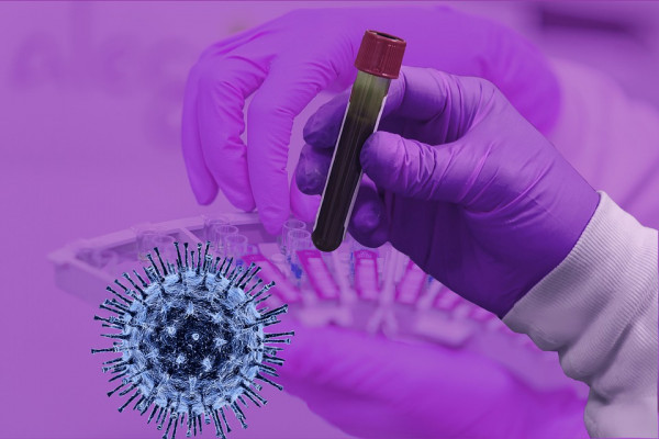 В Смоленской области провели более 347,5 тысяч тестов на наличие коронавируса