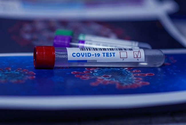 26911 человек заболели коронавирусом в Смоленской области 