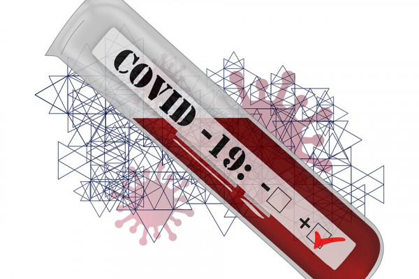 В Смоленской области с начала пандемии провели 364100 тестов на COVID-19