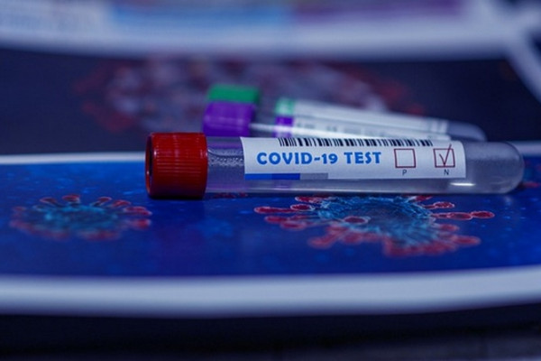 В Смоленской области число заболевших коронавирусом выросло до 32043 человек
