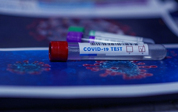 В Смоленской области выявили 64141 случай заболевания COVID-19