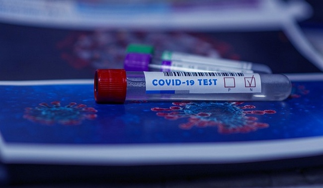 В Смоленской области выявили 64141 случай заболевания COVID-19