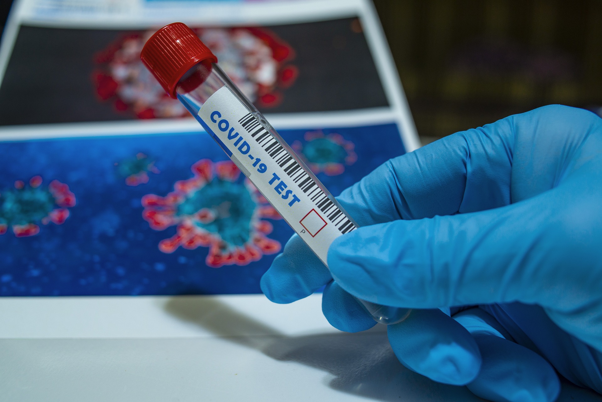 4495 тестов на коронавирус провели за сутки в Смоленской области