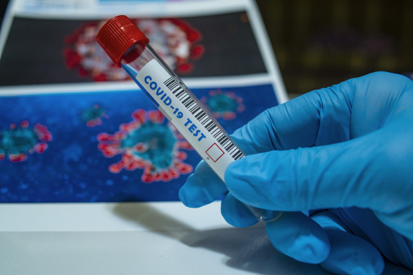 В Смоленской области за прошедшие сутки провели 3829 тестов на коронавирус