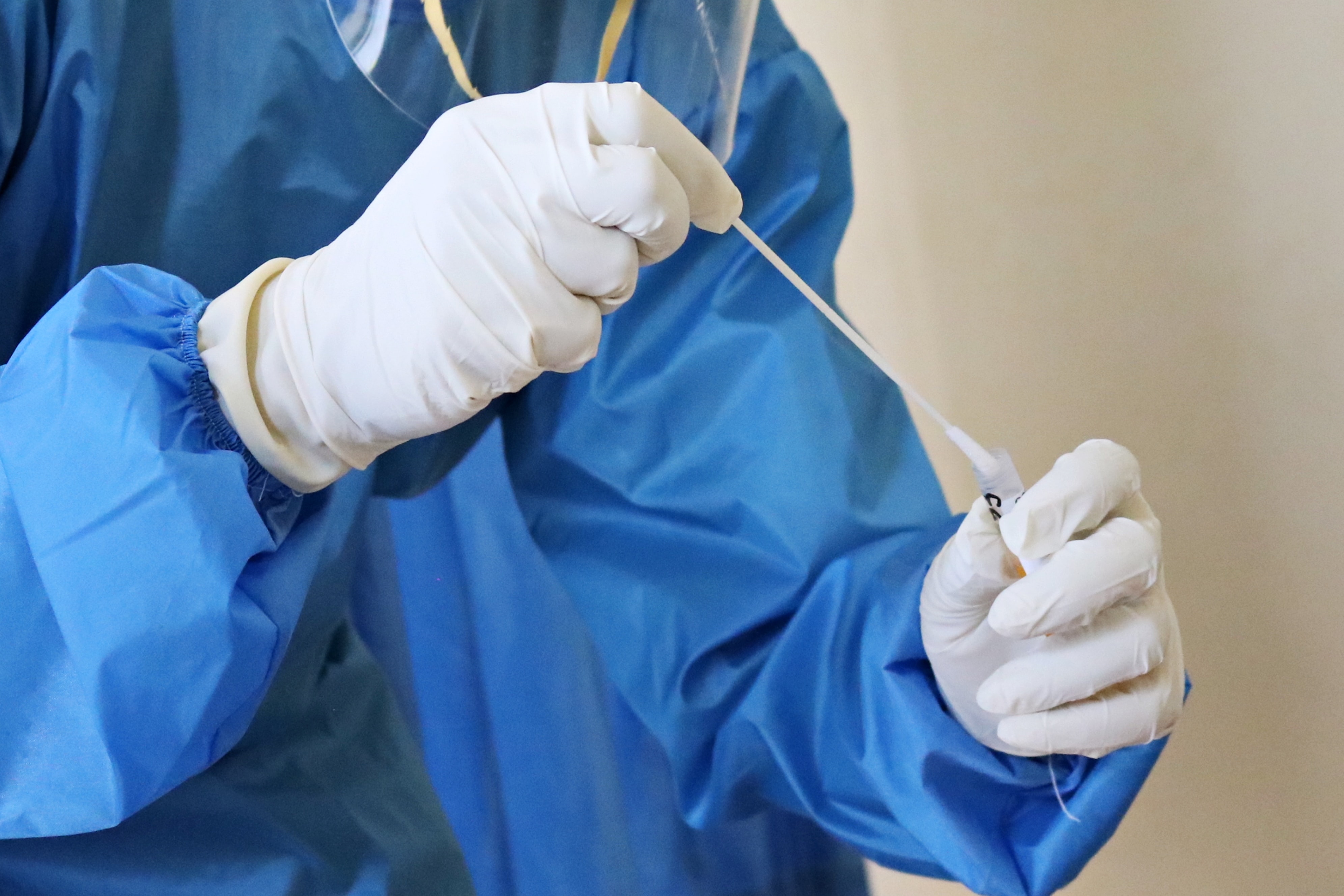 В Смоленской области выявили 32 случая заражения коронавирусом
