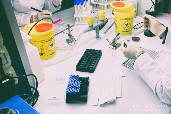 Смоленская область присоединилась к общероссийской акции против СПИДа