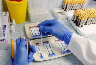 Заболеваемость ВИЧ в России сократилась вдвое за 10 лет