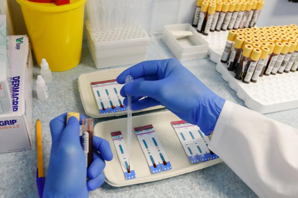 Заболеваемость ВИЧ в России сократилась вдвое за 10 лет